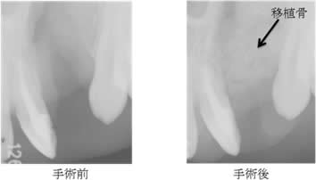 拡大装置(クワドヘリックス)