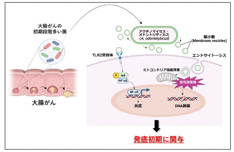 腸内細菌の”飛び道具”が大腸がんの原因に ～腸内細菌が産生する膜小胞が引き起こす大腸がん発生メカニズムの解明～