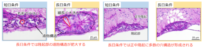 図1 下垂体隆起部