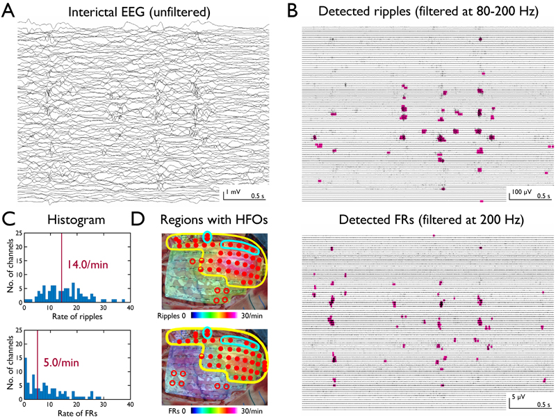 hfo_detection.jpg