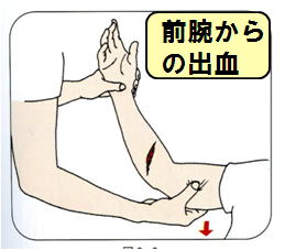外傷 事故防止と対策 岡山大学保健管理センター
