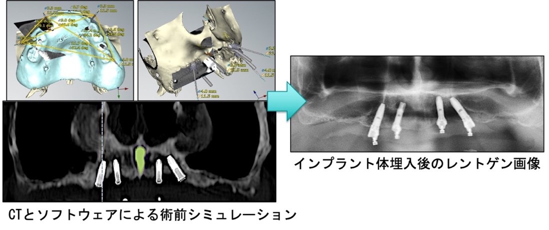 先端治療例0