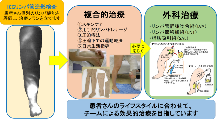 リンパ浮腫専門ケアチーム