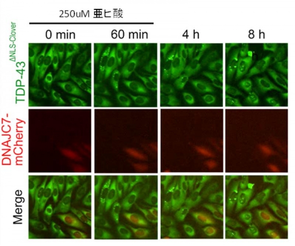 筋萎縮性側索硬化症（ALS）を引き起こす新たなメカニズムを解明～タンパク質を“片づける”遺伝子の機能が失われると運動神経細胞がダメージを受けることを発見～