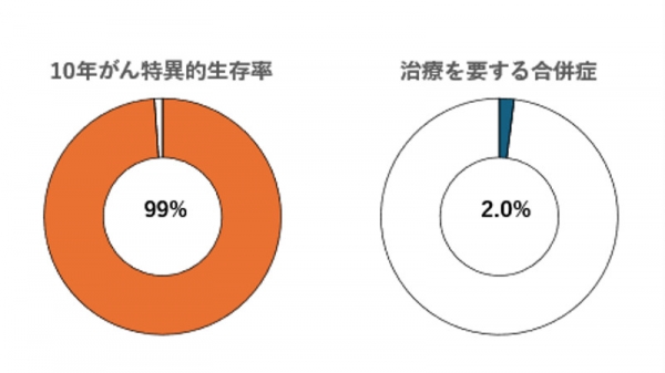 前立腺がんに対する密封小線源療法の長期経過を調査～良好かつ安全な治療成績を基に局所療法に応用～