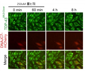筋萎縮性側索硬化症（ALS）を引き起こす新たなメカニズムを解明～タンパク質を“片づける”遺伝子の機能が失われると運動神経細胞がダメージを受けることを発見～