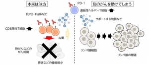 がん免疫療法使用中に隠れていたリンパ腫が見つかる場合がある