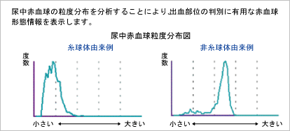 尿一般定性 尿沈渣