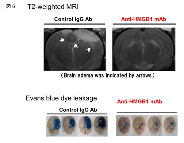 T2-weighted MRI